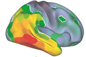 Tau-PET kann die Ausbreitung der Tau Pathologie bei Alzheimer Patienten sichtbar machen.