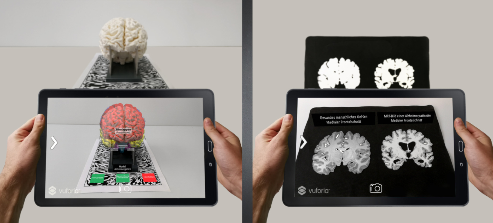 Foto: Alzheimer-Koffer, Technische Universität Kaiserslautern, 2018 Foto: Alzheimer-Koffer, Technische Universität Kaiserslautern, 2018
